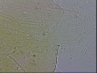 Echiniscus testudo image