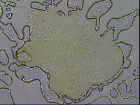 Echiniscus testudo image