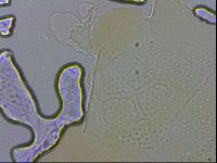 Echiniscus testudo image