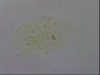 Echiniscus testudo image