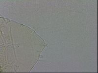 Echiniscus testudo image