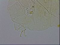 Echiniscus testudo image