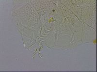 Echiniscus testudo image