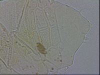 Echiniscus testudo image
