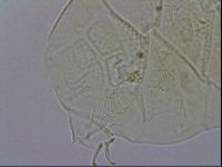 Echiniscus testudo image