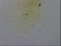 Echiniscus testudo image