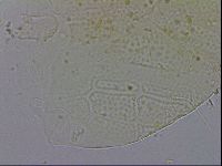 Echiniscus testudo image