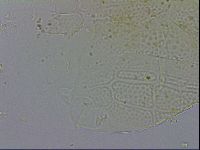 Echiniscus testudo image