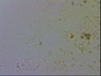 Echiniscus testudo image