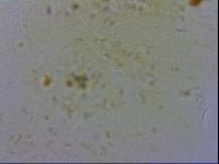 Echiniscus testudo image
