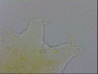 Echiniscus testudo image