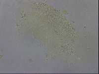 Echiniscus testudo image
