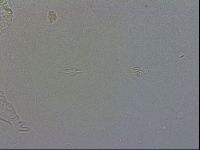 Echiniscus testudo image