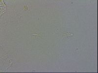 Echiniscus testudo image