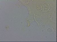 Echiniscus testudo image