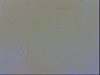 Echiniscus testudo image
