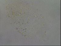 Echiniscus quadrispinosus brachyspinosus image
