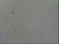 Echiniscus quadrispinosus brachyspinosus image