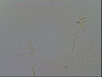 Echiniscus quadrispinosus brachyspinosus image