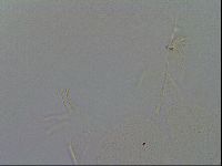 Echiniscus quadrispinosus brachyspinosus image