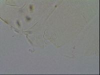 Echiniscus quadrispinosus brachyspinosus image