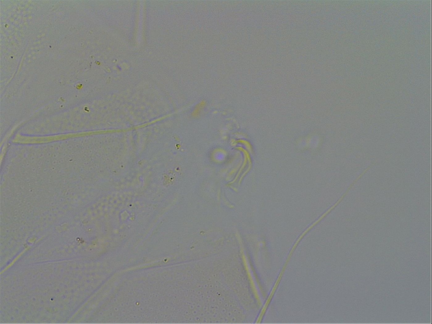 Echiniscus quadrispinosus brachyspinosus image