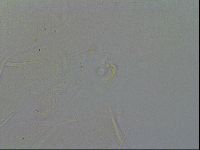 Echiniscus quadrispinosus brachyspinosus image