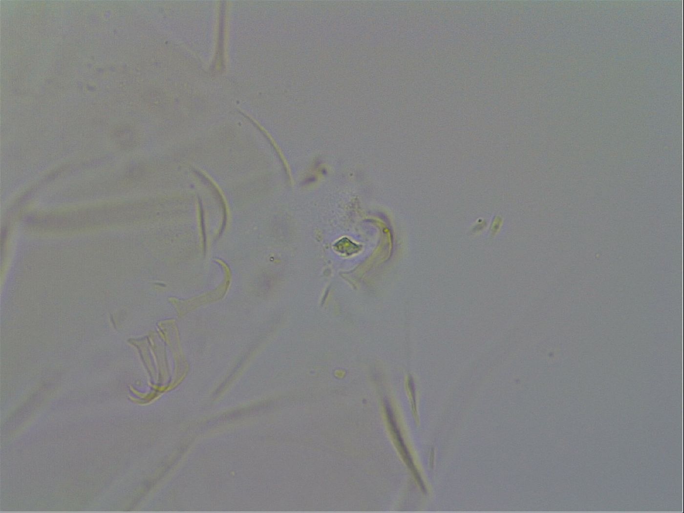 Echiniscus quadrispinosus brachyspinosus image