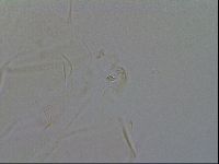 Echiniscus quadrispinosus brachyspinosus image