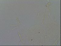 Echiniscus quadrispinosus brachyspinosus image