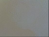 Echiniscus quadrispinosus image