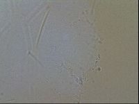 Echiniscus quadrispinosus image
