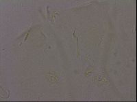 Echiniscus militaris image