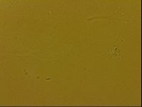Echiniscus quadrispinosus image