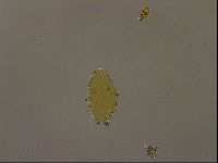 Echiniscus porabrus image