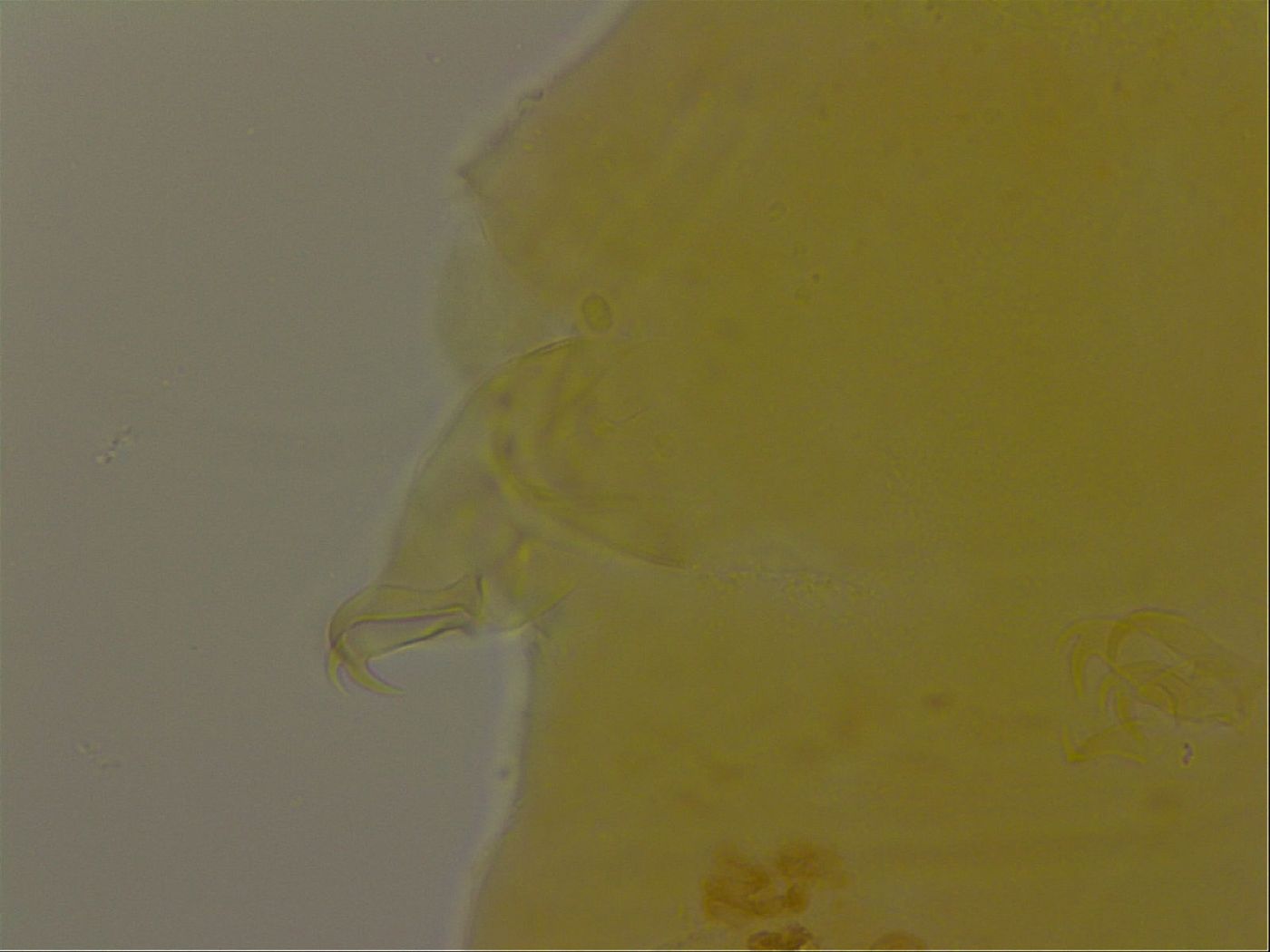 Echiniscus porabrus image