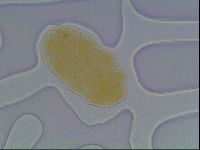 Echiniscus cavagnaroi image