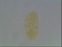 Echiniscus cavagnaroi image