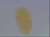 Echiniscus cavagnaroi image