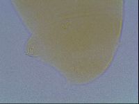 Echiniscus cavagnaroi image
