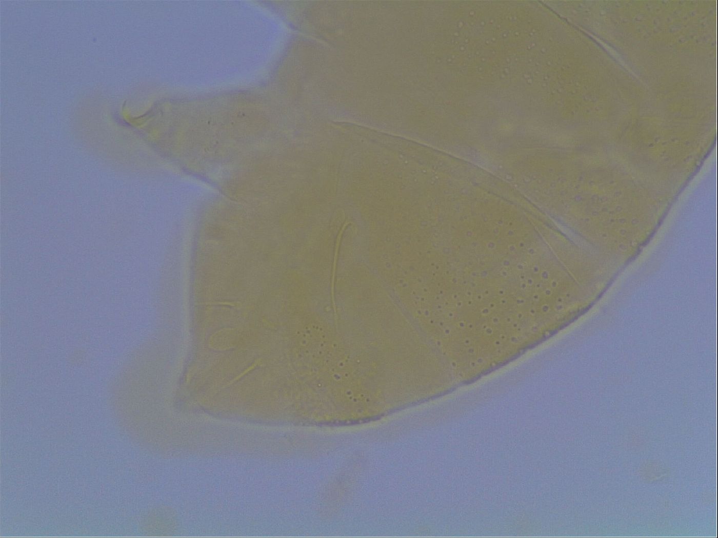 Echiniscus cavagnaroi image