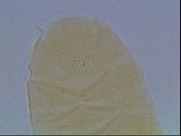 Echiniscus cavagnaroi image