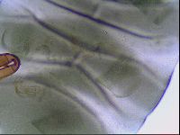 Echiniscus viridis image