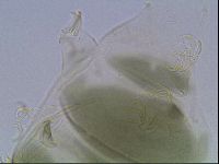 Echiniscus viridis image