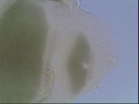 Echiniscus viridis image