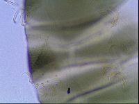 Echiniscus viridis image