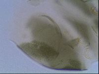 Echiniscus viridis image