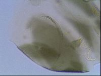 Echiniscus viridis image