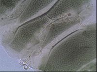 Echiniscus viridis image