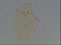 Echiniscus tessellatus image